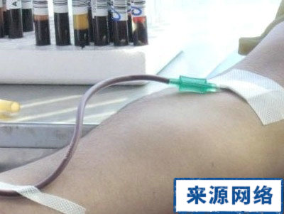 献血 输血 献血有害吗 献血害处 献血好处