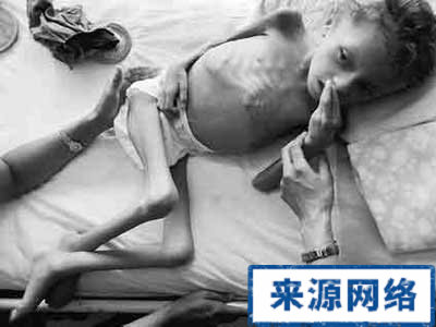 儿童保健 儿童营养不良的信号 儿童营养不良的原因