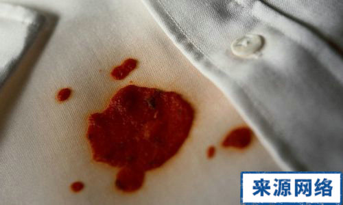 衣物污渍清洗妙招 油渍清洗妙招 衣服污渍