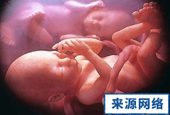 孕妇保健 孕妇怀双胞胎应怎么什么 双胞胎保健
