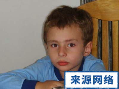 夏季保健 夏季儿童应防哪些病 夏季儿童保健