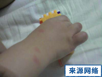 夏季养生 夏季如何防蚊虫 夏季防蚊虫有什么诀窍